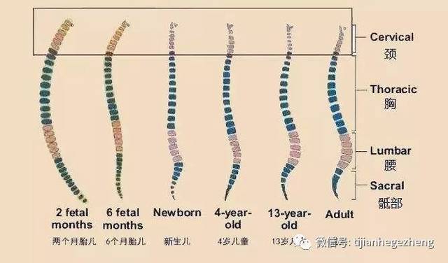 脊柱侧弯和驼背区别图图片