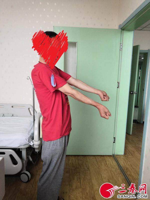 肠胃病也能导致风湿病?男子一觉睡醒胳膊肘伸不直