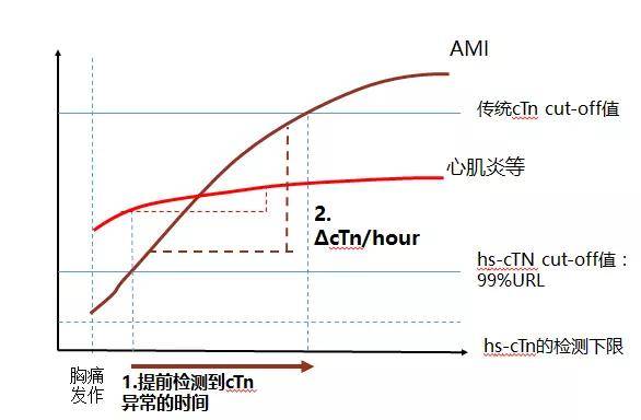 一文看懂cTnI、cTnT和hs-cTn的异同!