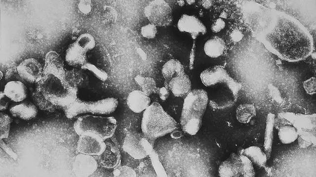 如果丧尸病毒真的爆发,那一定会被人类虐到灭