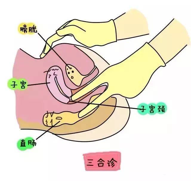 妇科检查小攻略专治各种不明白
