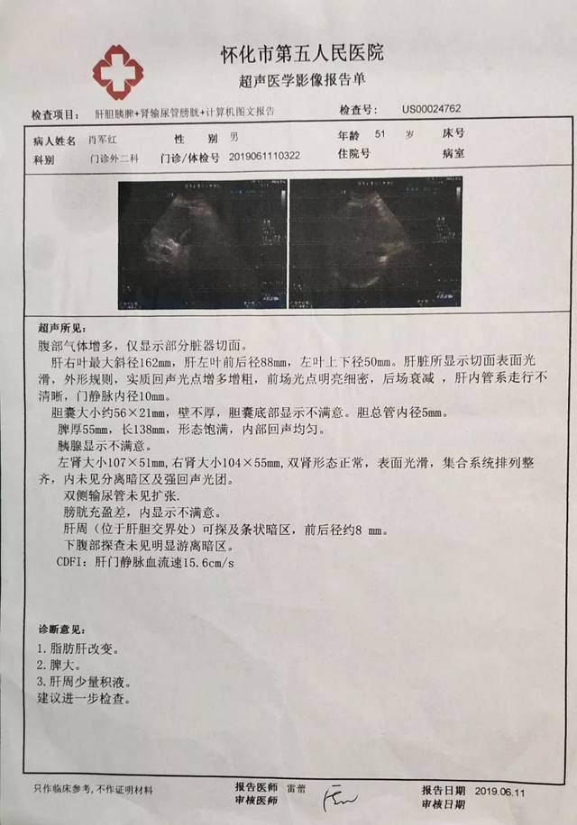 急性胰腺炎和心肌梗塞的八天康复