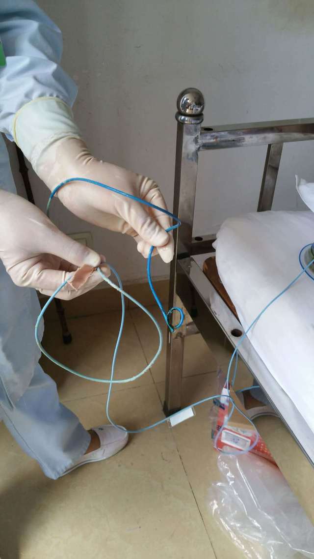 ercp鼻胆管可放多久?