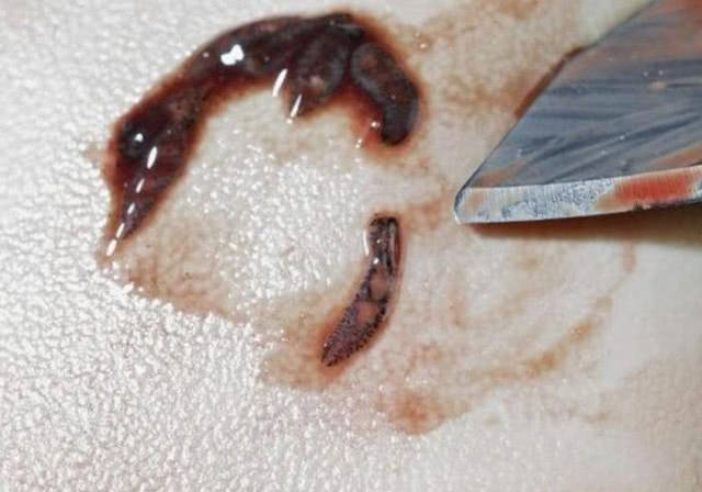 小龙虾体内到底有没有寄生虫?专家检测过后,结果让人意外!
