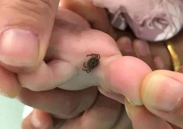 这种致命的小虫子进入活跃期!栖霞人注意了!_手机搜狐网