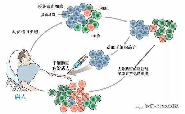 白血病治疗：新进展与挑战并存