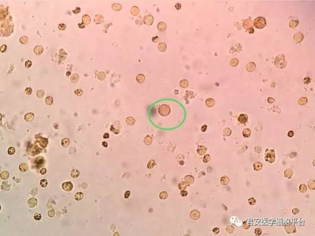 红箭头:结肠内阿米巴滋养体;绿圈:人芽囊原虫 碘染色 400× 和背景中