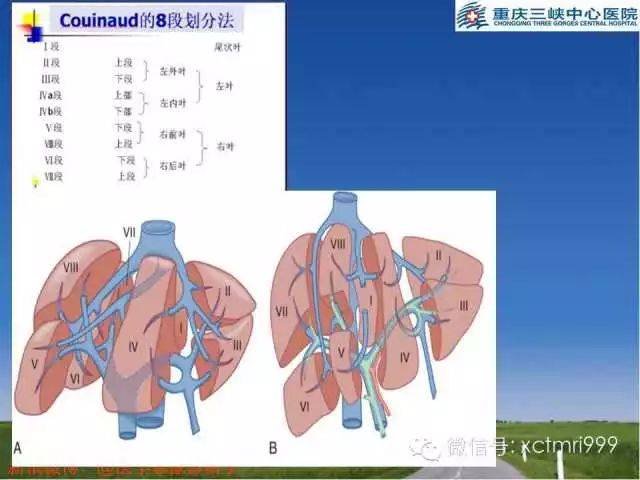 第三肝门立体图片图片