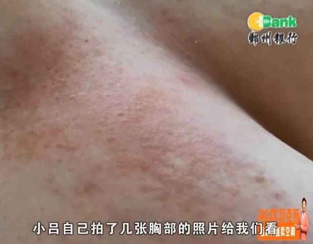 女生乳房头痒图片