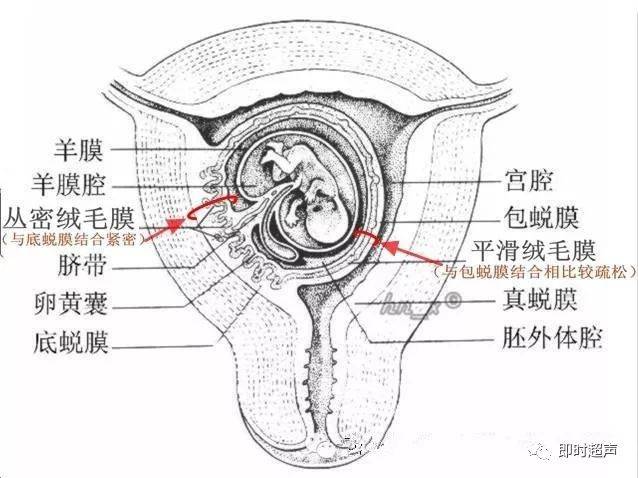 与胎盘无关系的混合性或无回声区(致密绒毛膜与底蜕膜联合形成胎盘