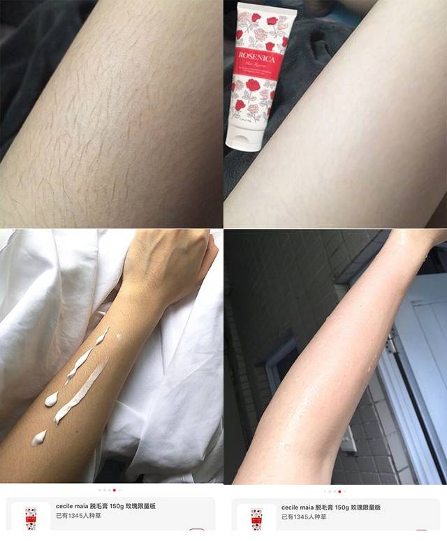 脱毛之后鸡皮肤身体变化(脱毛会使鸡皮肤更加严重吗)