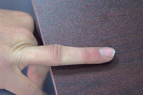 有没有癌症,看看手指就知道,手指出现一个征兆最好去检查一下