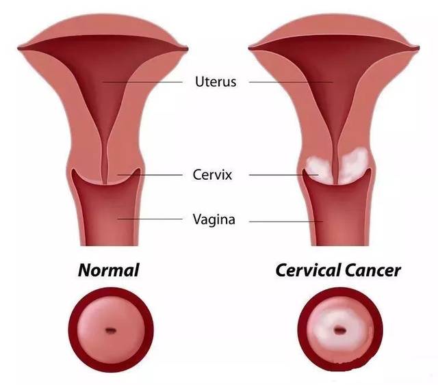 女性月经过程宫颈图片图片