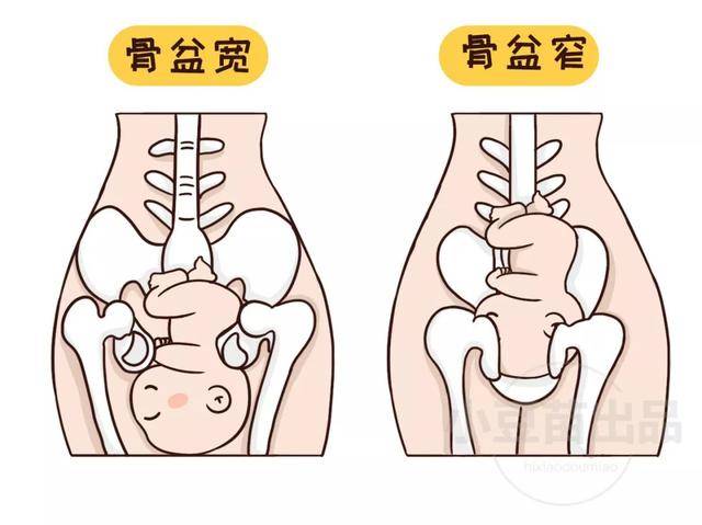 儿童骨盆图片