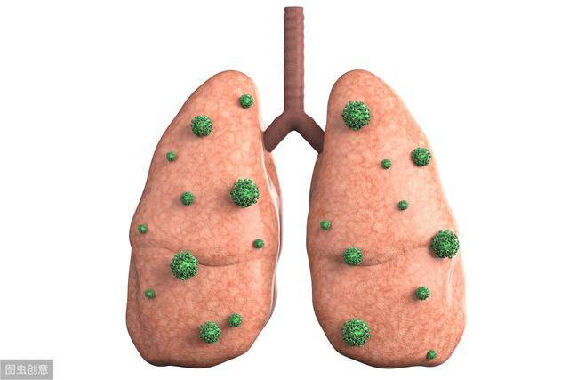 頻繁肺部疼痛多半和這4種疾病有關哪一個都需要引起重視