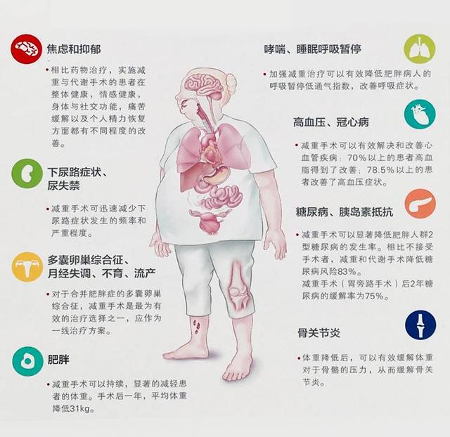 减肥手术多少钱_减肥手术哪种效果好_手术减肥