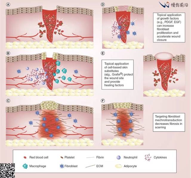 成纖維細胞和傷口癒合