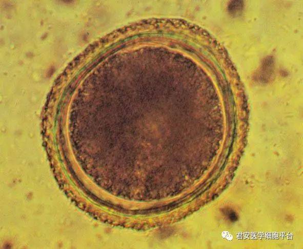 3 形态特征:虫卵近球形,大小为(69～95)μm ×(60～77)μm,黄褐色