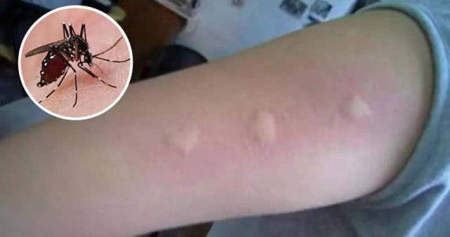 钓鱼担心蚊虫叮咬,不要怕,多年夜钓防蚊实践中有个绝招