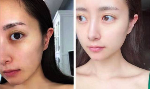 lily:皮肤一直比较黄,总被人说气色不好,喝了1个多月,皮肤白了2个度