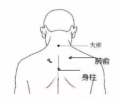 三伏贴,三伏灸,"冬病夏治"你准备好了吗?