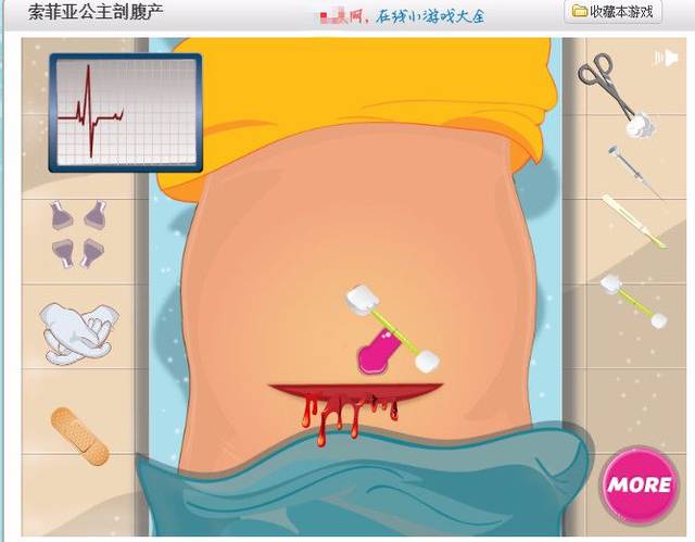 也存在一些类似的"手术"小游戏