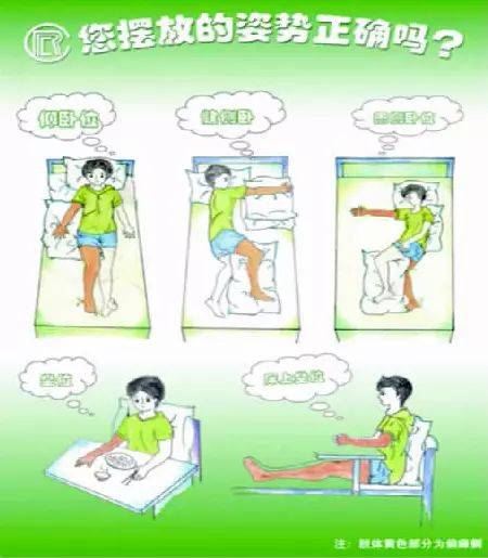 脑卒中患者良肢位的摆放,你都会了吗?
