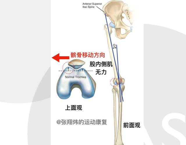 膝关节内旋外旋动作图图片