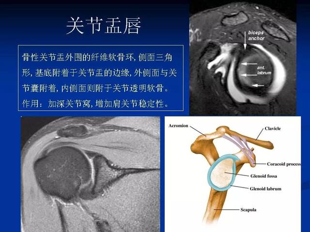 肩关节横断面解剖图图片