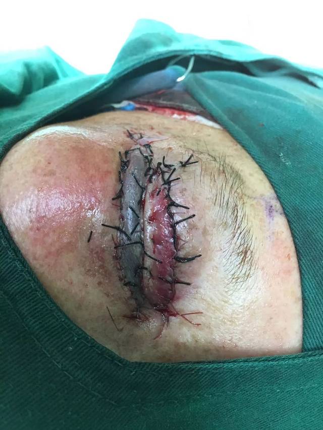 【关注】原来连二医这些技术这么牛!哪个是你心中的best,赶紧来投票吧