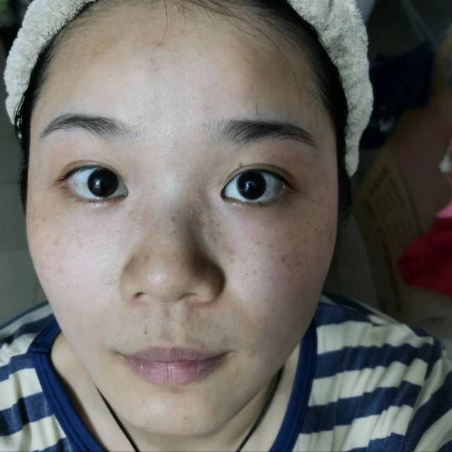 女人出现色斑也是衰老的一大表现,不管多么惊艳美丽的容貌,一旦长了
