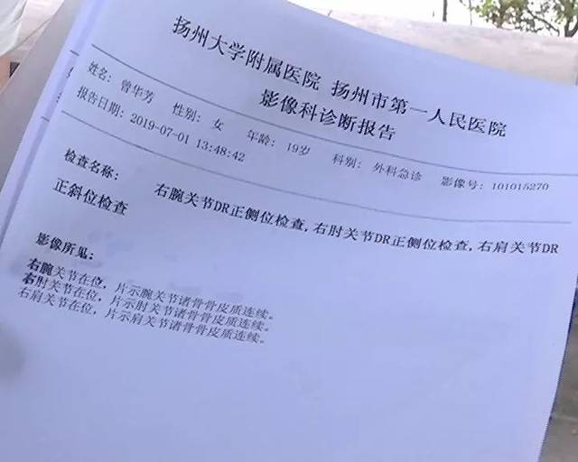 就是手 還有臉 臉也是 曾師傅:檢查下來就是軟組織損傷 骨頭沒受傷