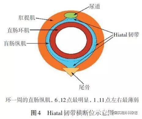 固定在肛提肌上,這部分肌肉分別在6,12點肥厚發達(6點尾骨方向最明顯)