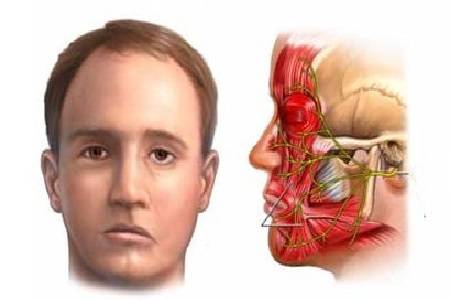 上唇方肌,起源于眶下孔上方,眶下缘的上颌部,此处位于眼轮匝肌的深部