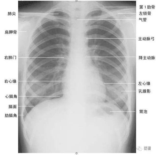 肺肋面图片