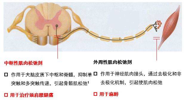 注射肌肉松弛剂很爽图片