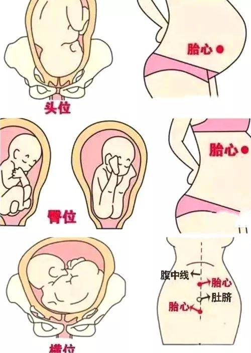 孕晚期胎心位置示意图图片
