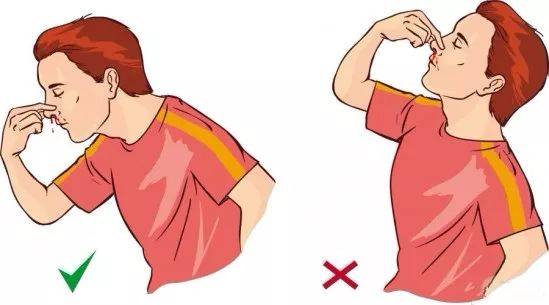 不要做:头部后仰(出血容易下咽,可能呛入肺中,造成危险).