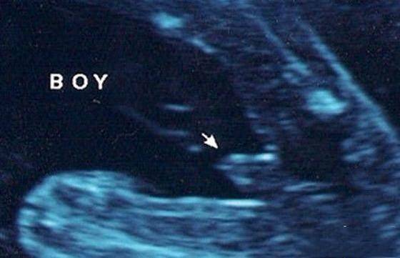 四维单子上有男女暗示吗?据说懂的人都这么看