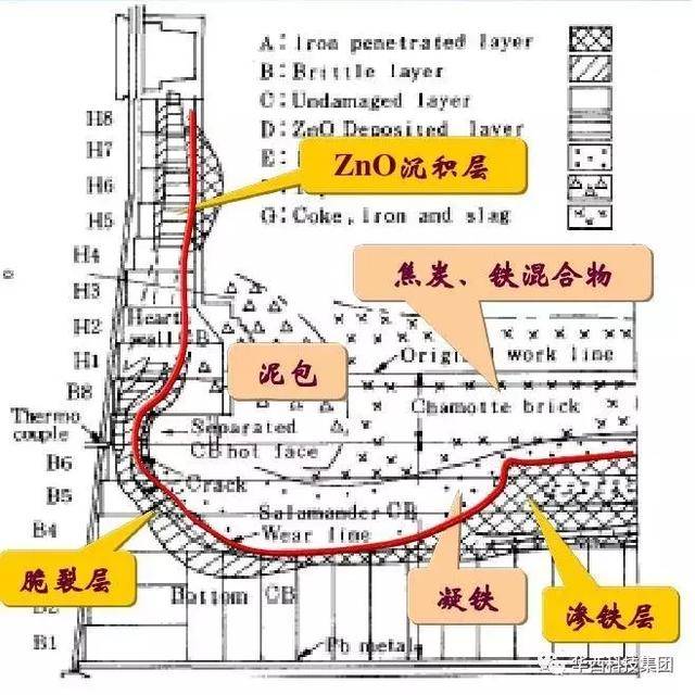 高炉炉缸象脚状侵蚀形成机理及解决方案