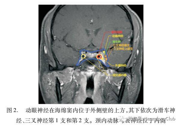 动眼神经mri影像解剖图图片