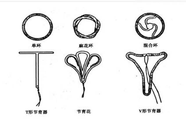 现身体受到节育环威胁?