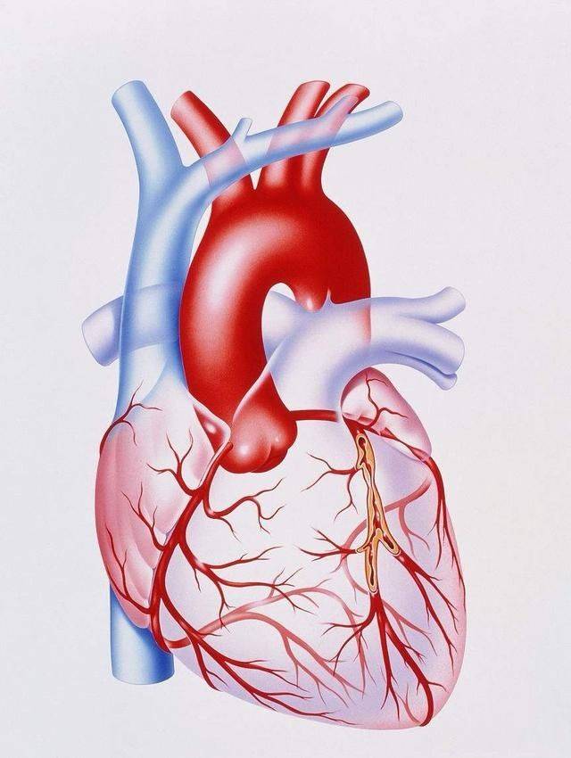 29歲,急性心肌梗死,為什麼沒有支架?醫生:心梗並不都放支架_手機搜狐