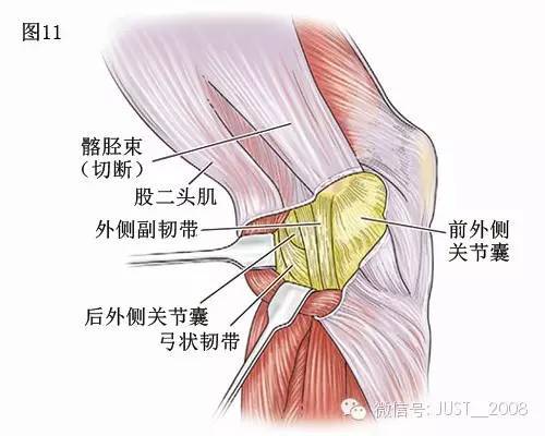 膝关节解剖学:膝关节的四面观