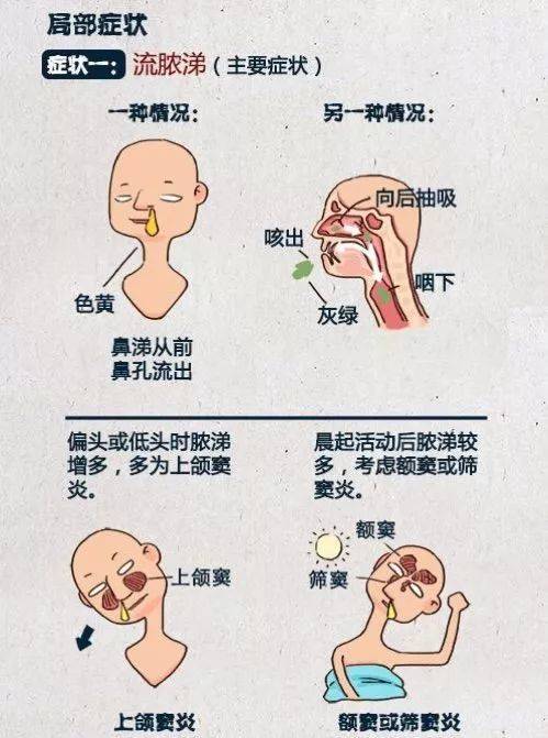 鼻屎是怎么形成的图片