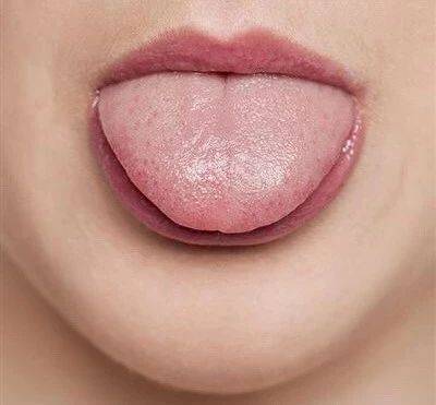 健康的"放大镜" ——舌头