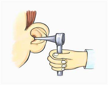 耳鼻喉检查卡通图片