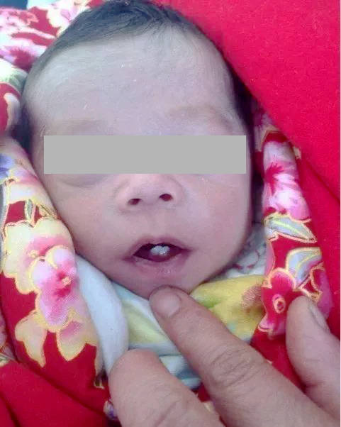 婴儿初期长牙图片图片