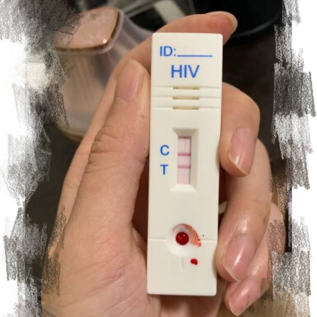 hiv弱阳性试纸图片