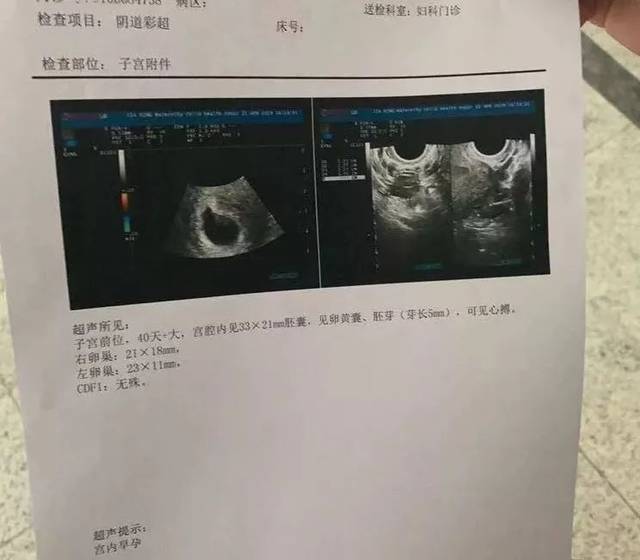 月经干净第1天同房,女朋友肚子里的孩子是不是